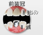 bad_tooth_01.jpg